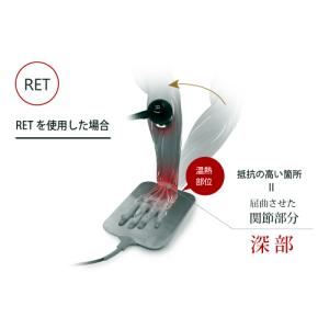 フィジオ ラジオスティムプロ P-RF-PRO...の詳細画像5