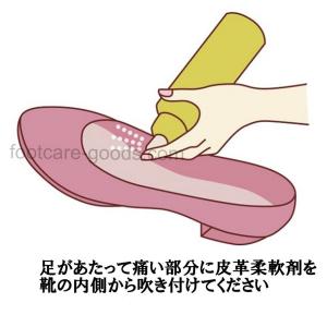 靴の部分伸ばしに「足痛部拡張器ポイントストレッ...の詳細画像1