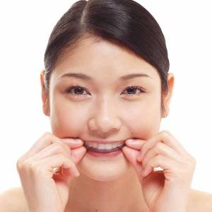 マウスピース いびき 噛み合わせマウスピース(...の詳細画像1