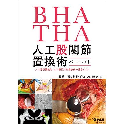 BHA・THA 人工股関節置換術パーフェクト?人工骨頭置換術・人工股関節全置換術の基本とコツ