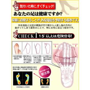 サポーター 中足関節 補整 固定 保護パッド ...の詳細画像3