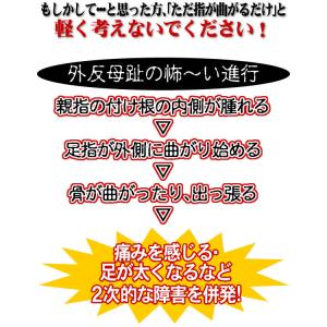 サポーター 中足関節 補整 固定 保護パッド ...の詳細画像5