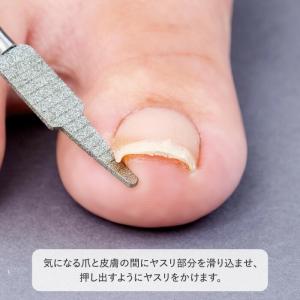 ダブルヘッド巻爪ヤスリ 巻き爪 爪やすり やす...の詳細画像3