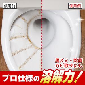 プロユース尿石落としジェル トレシャイン 尿石...の詳細画像2