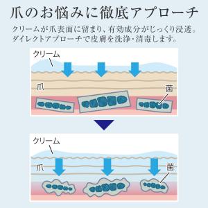 ビューナ 薬用足爪きれいα 指定医薬部外品 ク...の詳細画像3