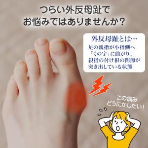 やわらかゲル付き外反母趾足指サック(2個入) ...の詳細画像1