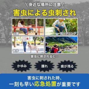 キュパット吸引 ポイズン リムーバー レジャー...の詳細画像1