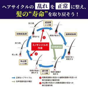 【第1類医薬品】 ミノキシジル 配合外用液 5...の詳細画像5