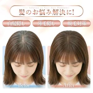 【人工頭皮付き】美シルエットヘアピース 部分ウ...の詳細画像4