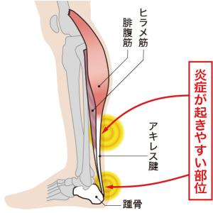 アキレス腱保護サポーターEX 大事な踵を覆い適...の詳細画像2