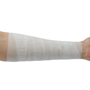 アルケア ハイスパン(R)・E 4号 伸縮包帯の詳細画像1