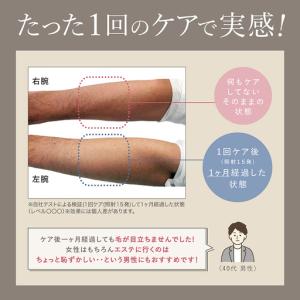 ふるさと納税 LINKA エピゼロ(IPL光脱...の詳細画像2
