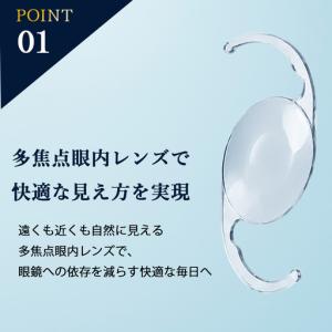 ふるさと納税 【眼科】多焦点眼内レンズによる先...の詳細画像2