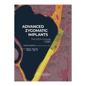 【取寄品】【取寄時、納期1〜3週間】ADVANCED ZYGOMATIC IMPLANTS　日本語版...