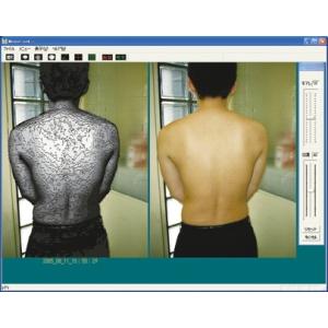 モアレ式体型観察装置　モアレルック 基本セット・PC付 ＊メーカー保証登録後出荷