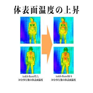 ABAND アンクルバンド 足首サポーター 足...の詳細画像2
