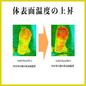 ABAND アンクルバンド 足首サポーター 足...の詳細画像3