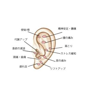 耳ツボシール 100粒 1000円ポッキリ 爆...の詳細画像1