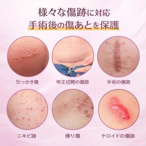 傷あとケアテープ 1.5m 3m 帝王切開 傷...の詳細画像3