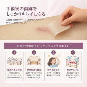 傷あとケアテープ 1.5m 3m 帝王切開 傷...の詳細画像2