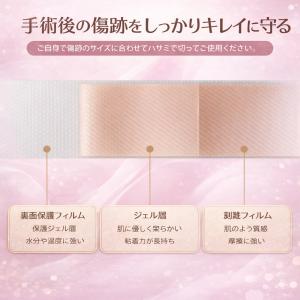 傷あとケアテープ 1.5m 3m 帝王切開 傷...の詳細画像5