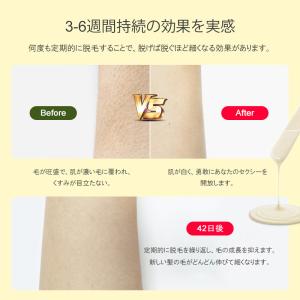 脱毛ワックス ビーズ G20120250 ブラ...の詳細画像3