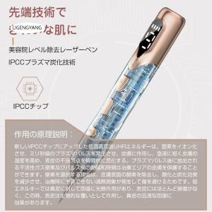 レーザーペン レーザー除去ペン 美顔器 シミ取...の詳細画像2