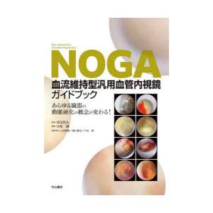 NOGA血流維持型汎用血管内視鏡ガイドブック あらゆる臓器の動脈硬化の概念が変わる!