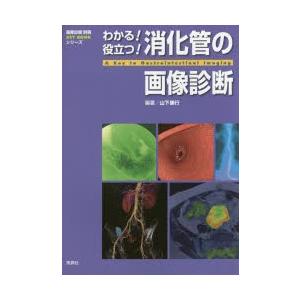 わかる!役立つ!消化管の画像診断