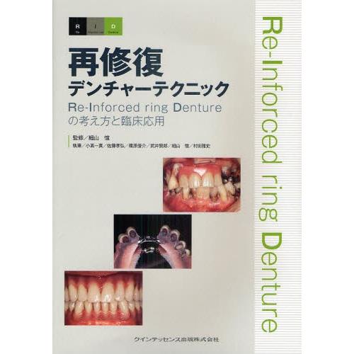 再修復デンチャーテクニック Re‐Inforced ring Dentureの考え方と臨床応用