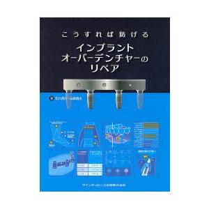 こうすれば防げるインプラントオーバーデンチャーのリペア｜ggking