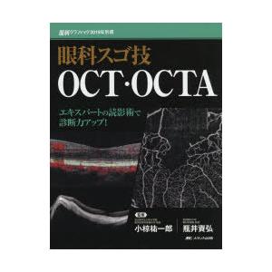 眼科スゴ技OCT・OCTA エキスパートの読影術で診断力アップ!｜ggking