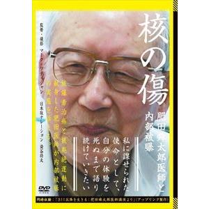 核の傷：肥田舜太郎医師と内部被曝 [DVD]
