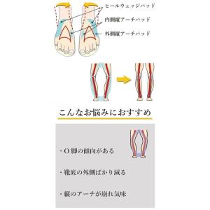 【メール便対応】村井 インソールプロ O脚対策...の詳細画像1