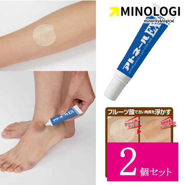 2個セット マイノロジ アトネール EX 15g かかと パック くるぶし 黒ずみ 角質 硬化 除去...