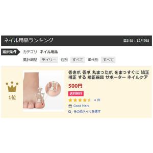 巻き爪 巻爪 巻爪矯正器 丸まった爪 をまっす...の詳細画像2