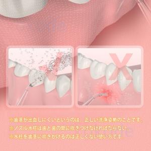 <限定:ノズル無料GET>口腔洗浄...の詳細画像3