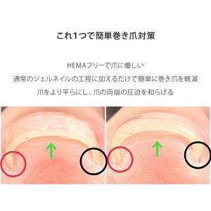 HEMAフリー 簡単巻き爪策 巻き爪策 巻き爪...の詳細画像1
