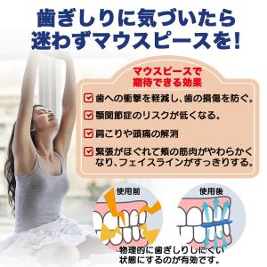 デンタル マウスピース 噛み合わせ 歯ぎしり ...の詳細画像5