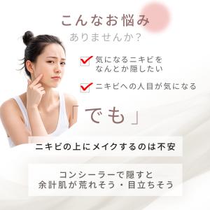 ニキビ×美白のW 有効成分配合|薬用アクネケア...の詳細画像2