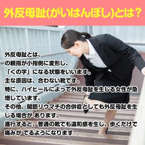 外反母趾 サポーター 親指 矯正 衝撃吸収 足...の詳細画像2