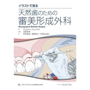 イラストで見る 天然歯のための審美形成外科