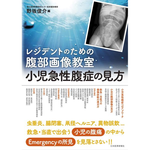 レジデントのための腹部画像教室小児急性腹症の見方