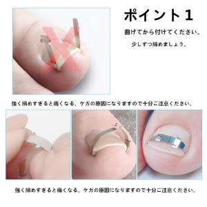 巻き爪ケアクリップ ワイヤー ガード 爪ブロッ...の詳細画像1