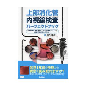 上部消化管内視鏡検査パーフェクトブック 早期病変を見逃さないための基本テクニック・経年発見症例から学ぶ｜guruguru