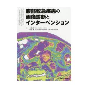 腹部救急疾患の画像診断とインターベンション