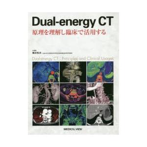 Dual‐energy CT 原理を理解し臨床で活用する｜guruguru