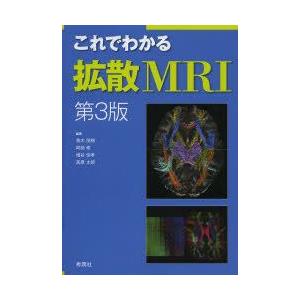 これでわかる拡散MRI