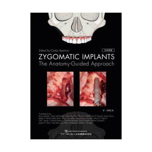 ZYGOMATIC IMPLANTS The Anatomy‐Guided Approach 日本語版