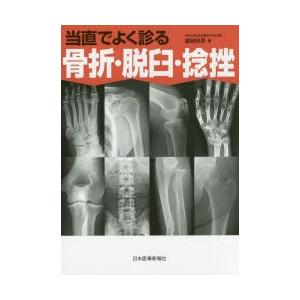 当直でよく診る骨折・脱臼・捻挫